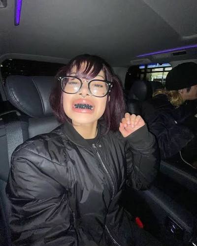 Molly Santana with blackened teeth